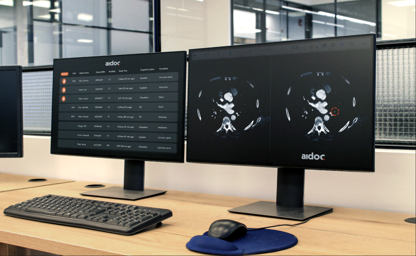 Una computadora con inteligencia artificial analiza una tomografía computarizada